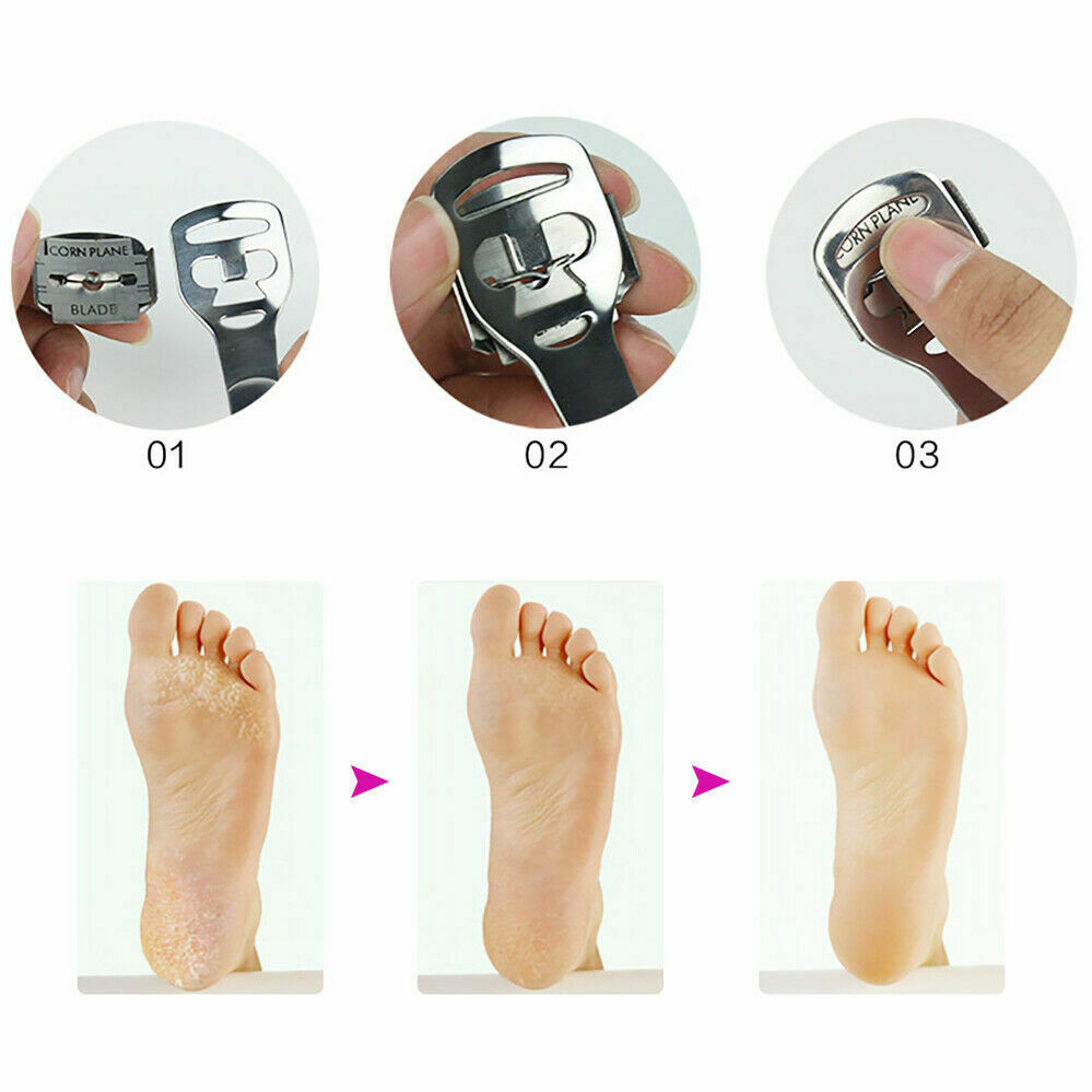 6 Pc Callus Remover Feet Hard Skin Remover Corn Shaver Pedicure